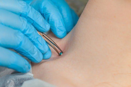 microdermal piercinger