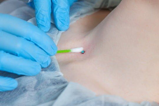 microdermal piercinger